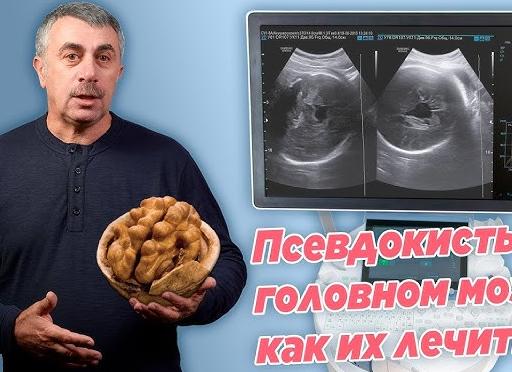 Киста в голове у грудничка что это такое Киста в голове у грудничка что это такое