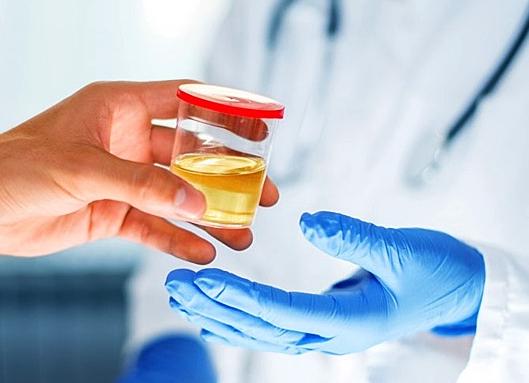 Если у ребенка моча пахнет аммиаком