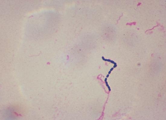 Что такое стрептококк и как его лечить