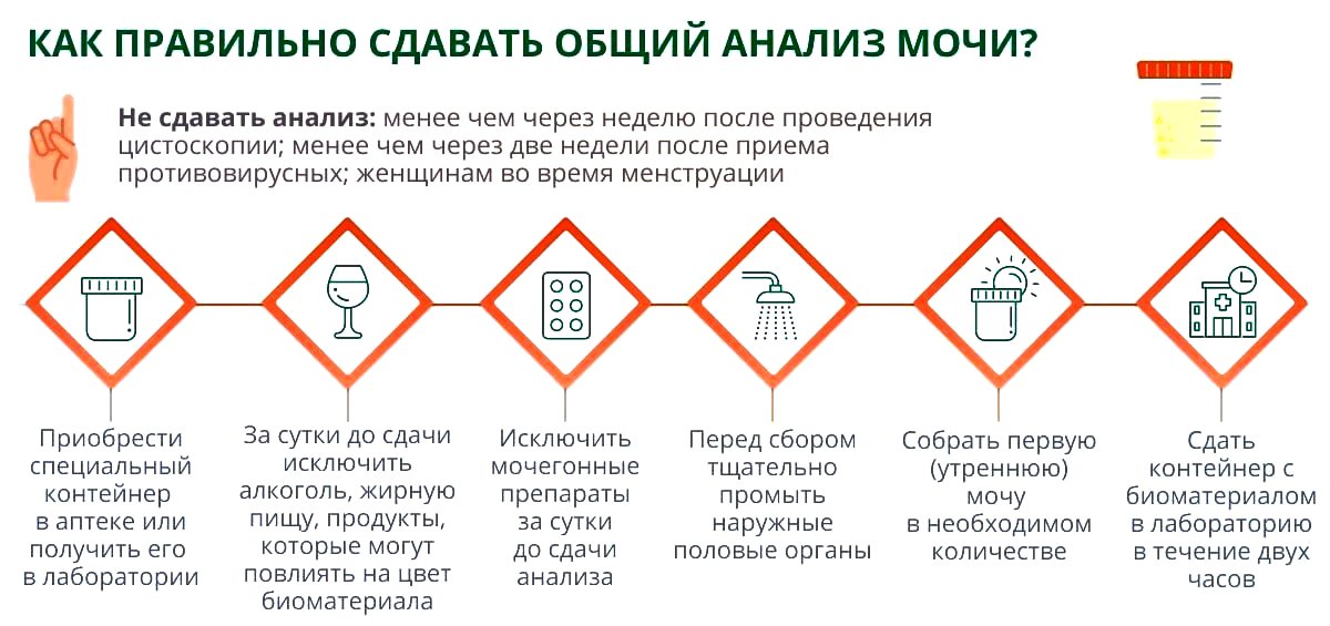 Как правильно собрать мочу на бакпосев у женщин