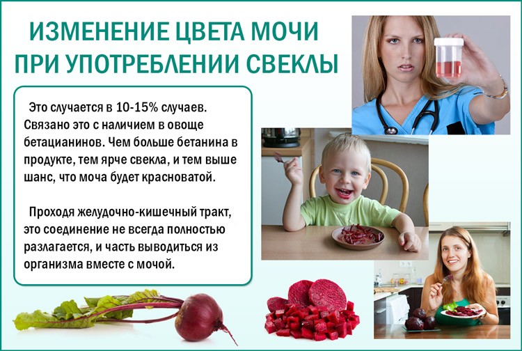 Может ли после свеклы быть красная моча