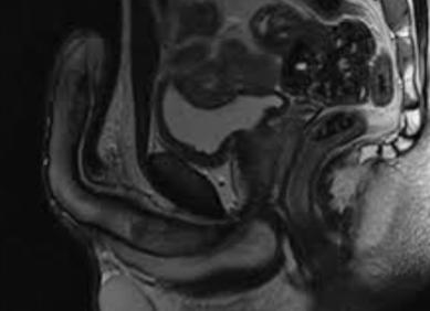 Мрт малого таза у мужчин с контрастом что показывает Мрт малого таза у мужчин с контрастом что показывает