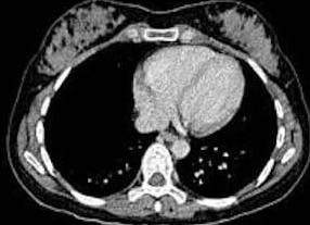 Кт молочных желез