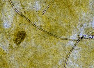 Кал с зеленоватым оттенком у взрослого