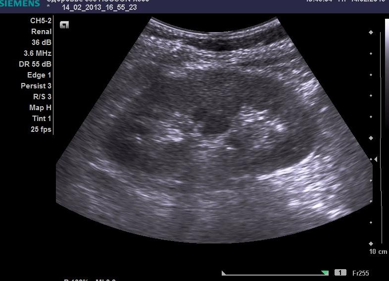 Как подготовиться к исследованию узи почек