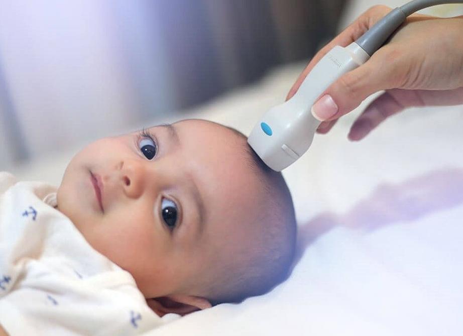 Как называется узи головного мозга Как называется узи головного мозга