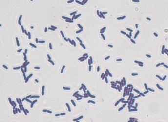 Эубактериум спп у женщин