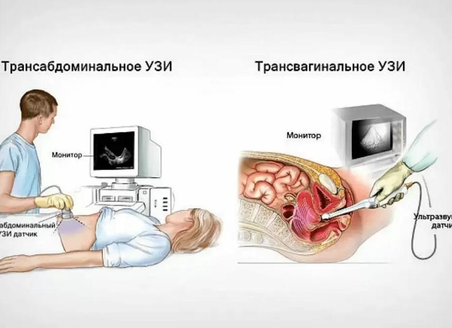 Что такое ультразвуковая диагностика