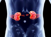 Что означает повышенная мочевина в анализе крови