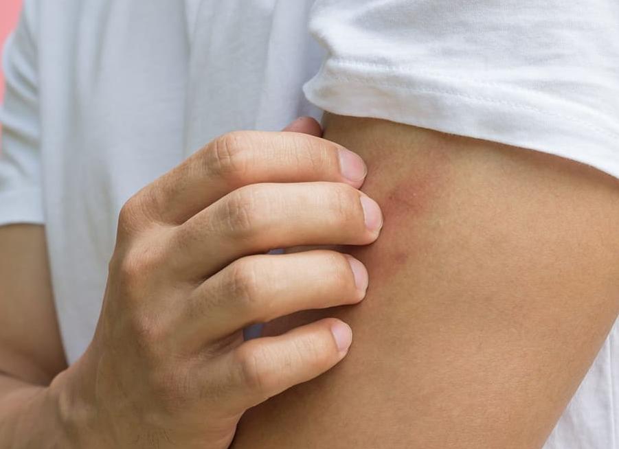 Через сколько проявляется вич у мужчин Через сколько проявляется вич у мужчин