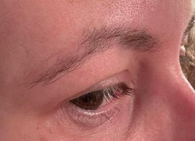 Через какое время можно повторно делать мрт Через какое время можно повторно делать мрт