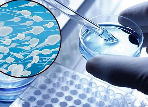 Биохимический анализ спермы