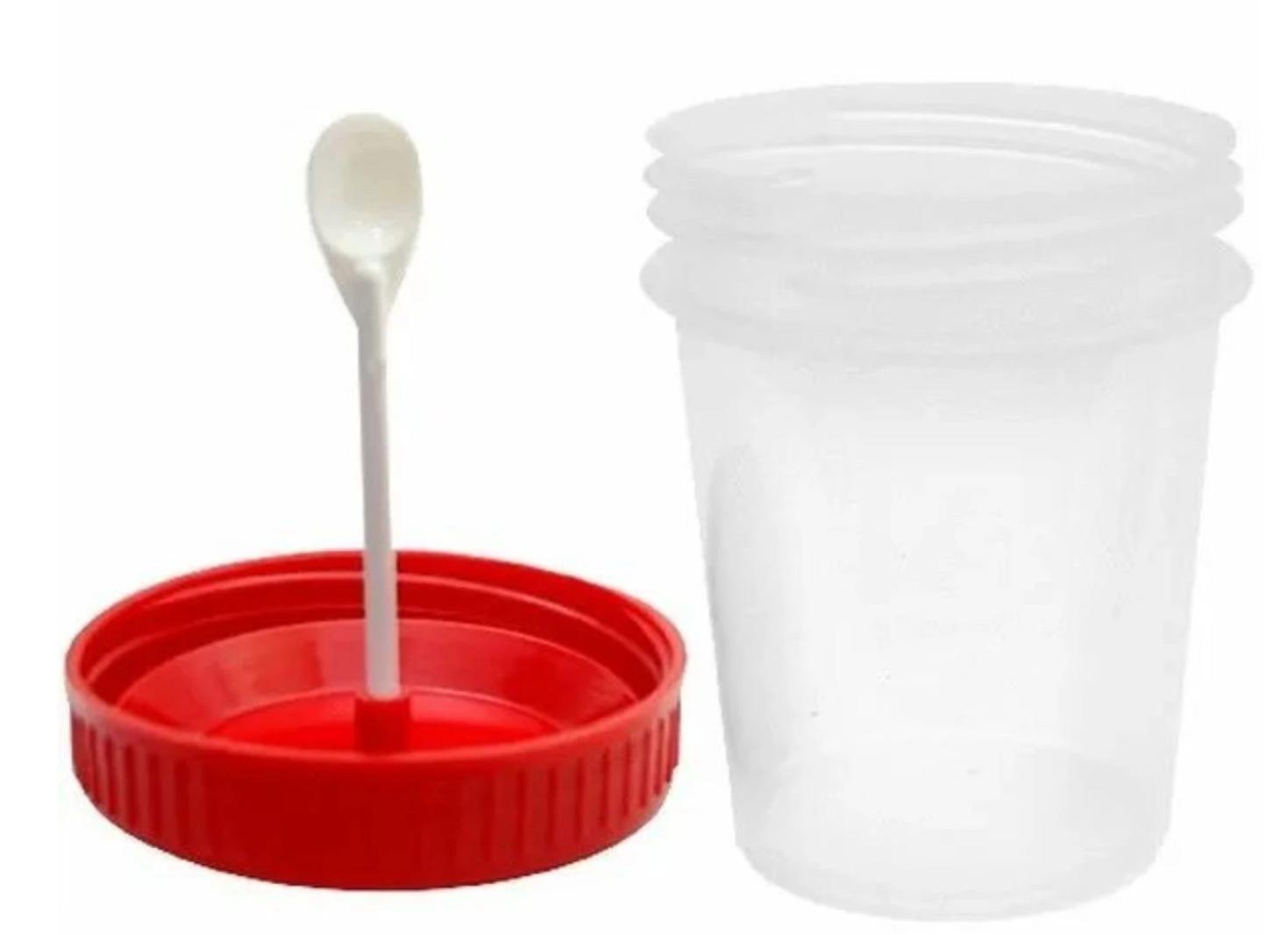 Анализы кала виды