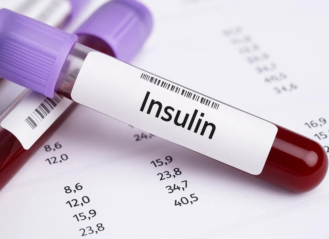 Анализ крови на инсулин что показывает