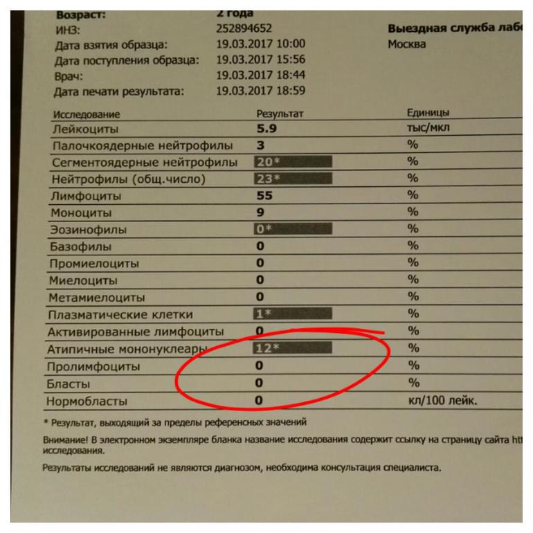 Как по анализу крови определить мононуклеоз
