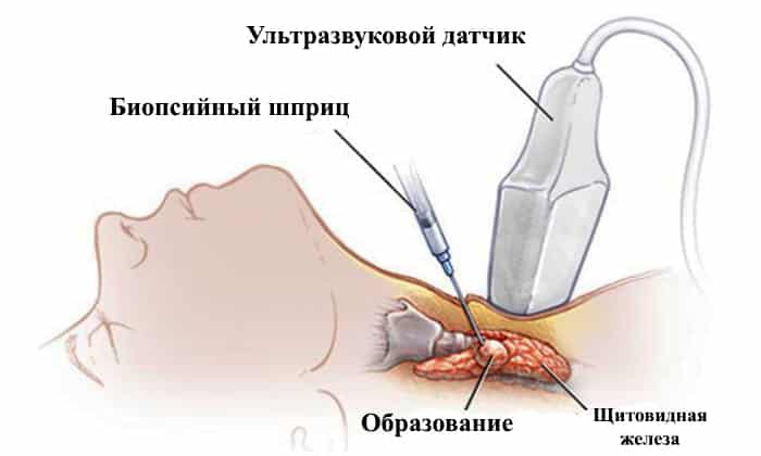 Кровь на биопсию это что