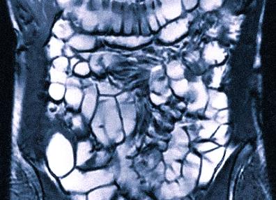 Мрт желудка и кишечника