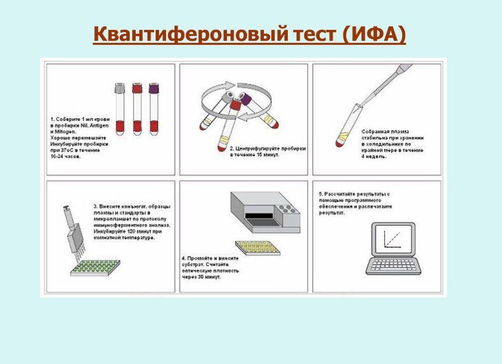Квантифероновый тест на туберкулез Квантифероновый тест на туберкулез