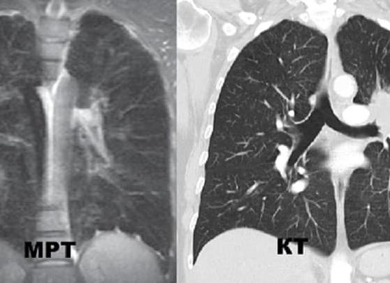 Кт или мрт легких что лучше