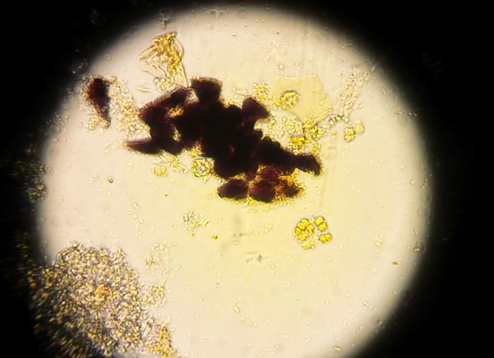 Крахмал внеклеточный в кале у ребенка что это значит