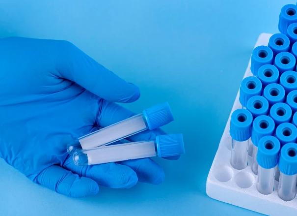 Анализ на наличие наркологических веществ