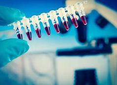 Анализ крови на уреаплазму Анализ крови на уреаплазму