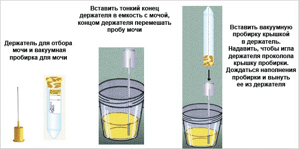 Моча по нечипоренко как собирать