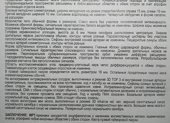 Мрт головного мозга анализ Мрт головного мозга анализ