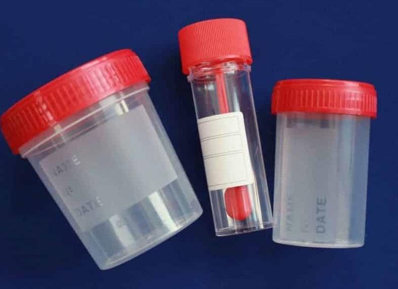 Можно ли хранить кал в холодильнике на яйца глист