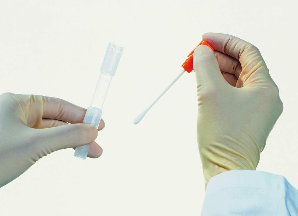 Мазок на бакпосев