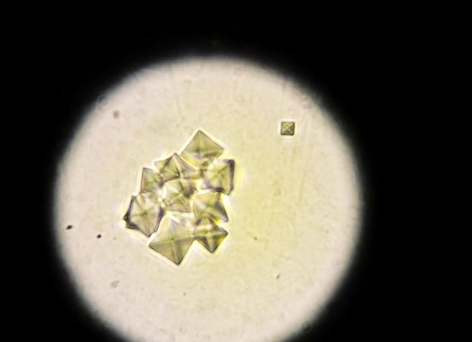 Кристаллы оксалата кальция в моче что это значит