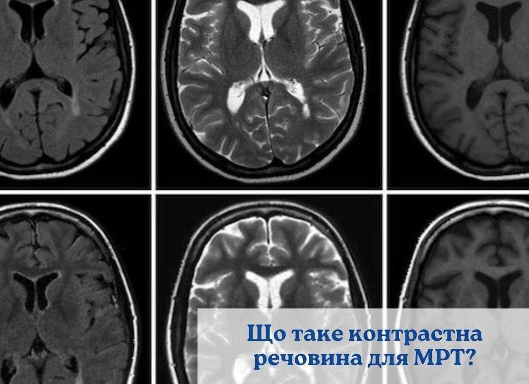 Контрастное вещество для мрт