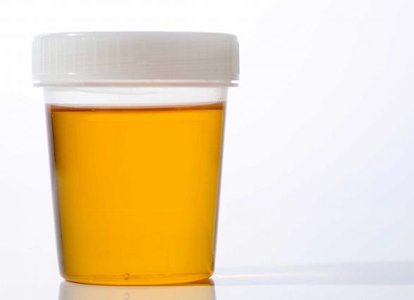 Какой цвет мочи должен быть у здорового человека