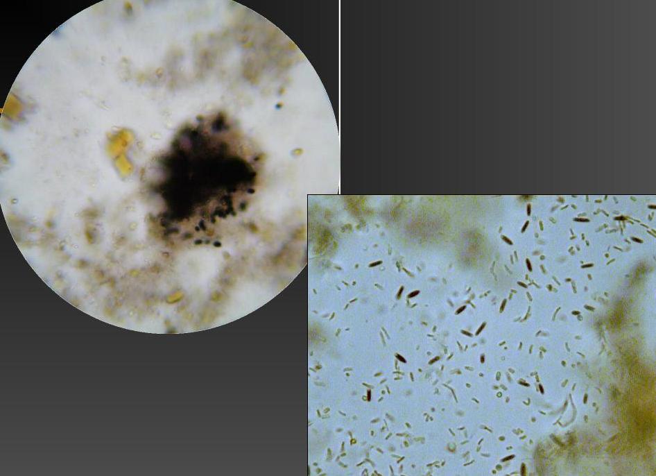 Йодофильная флора нормальная