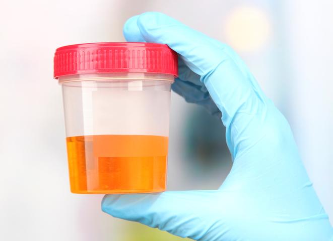 Гемоглобин следы в моче что это значит