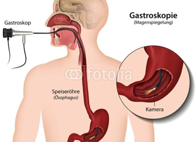 Эзофагогастроскопия что это такое
