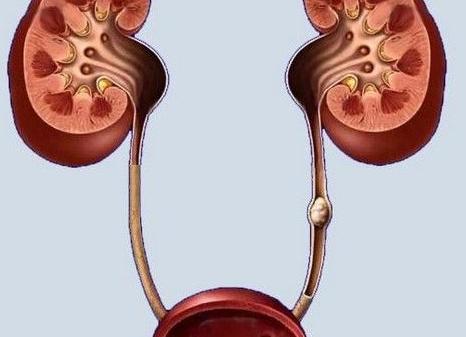 Диаметр мочеточника в норме у мужчин