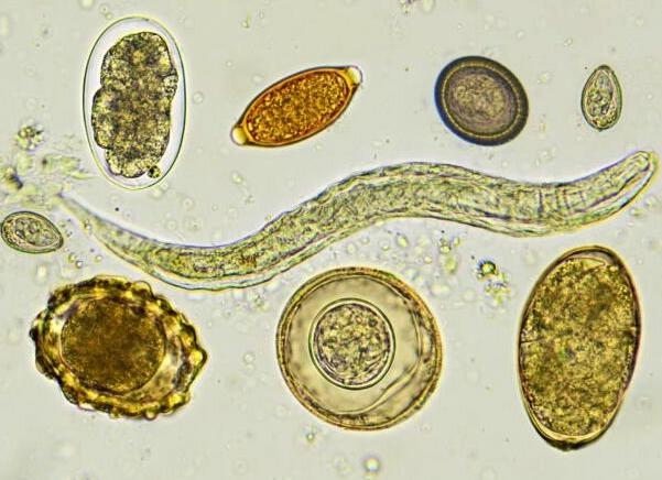 Цисты простейших в кале