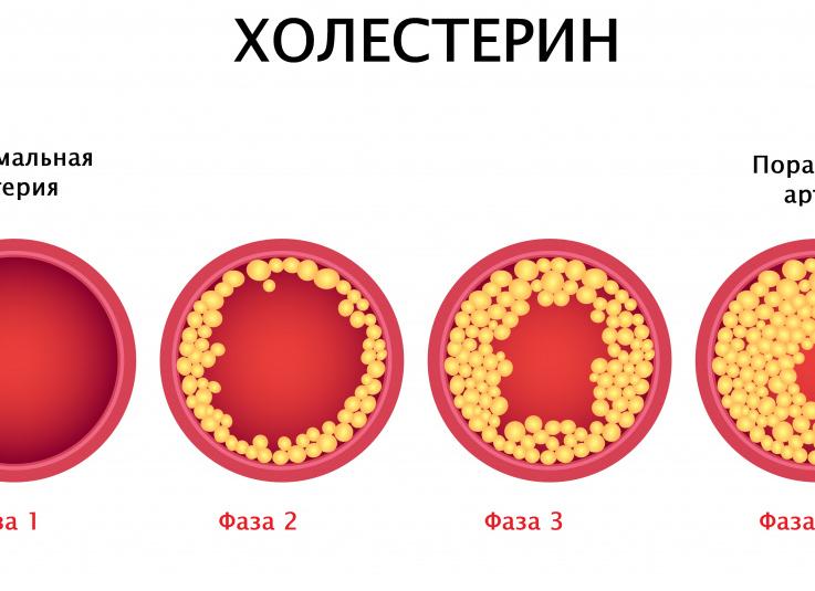 Аст в крови что такое