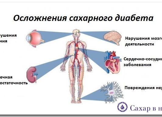 Анализ мочи на сахар как сдавать Анализ мочи на сахар как сдавать