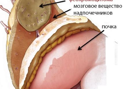 Анализ мочи на метанефрин и норметанефрин