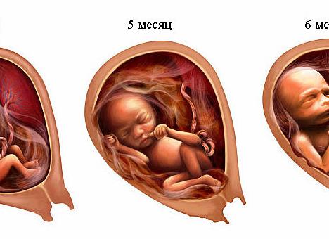2 й скрининг