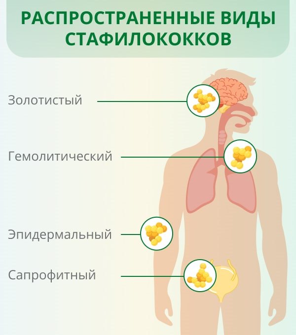 Как называется анализ на стафилококк