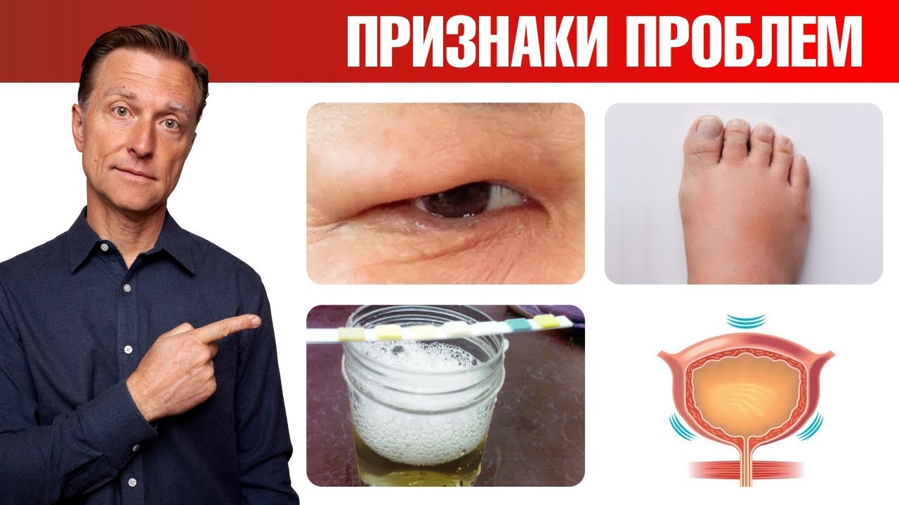 Как понять что у тебя проблемы с почками