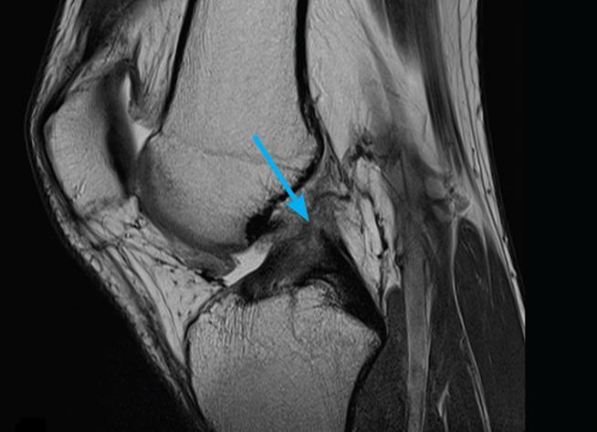 Мрт коленного сустава сколько длится Мрт коленного сустава сколько длится