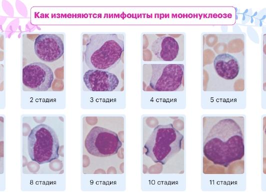 Мононуклеары в крови у ребенка норма