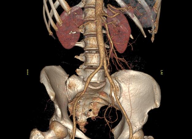 Кт органов брюшной полости и забрюшинного пространства что показывает