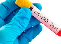 Кровь са 125 на что это такое