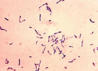 Коринеформные бактерии в мазке у женщин Коринеформные бактерии в мазке у женщин