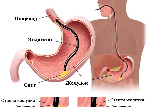 Хеликобактер пилори передается